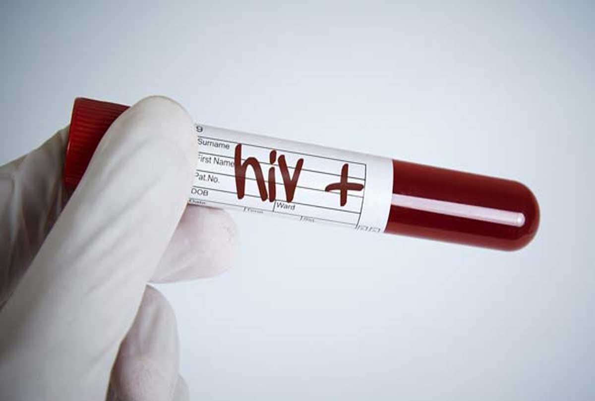 village where people infected with HIV