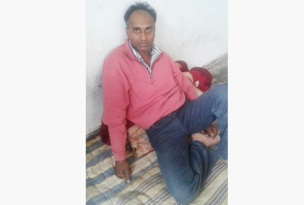 Class 12 student critical after man throws acid on her