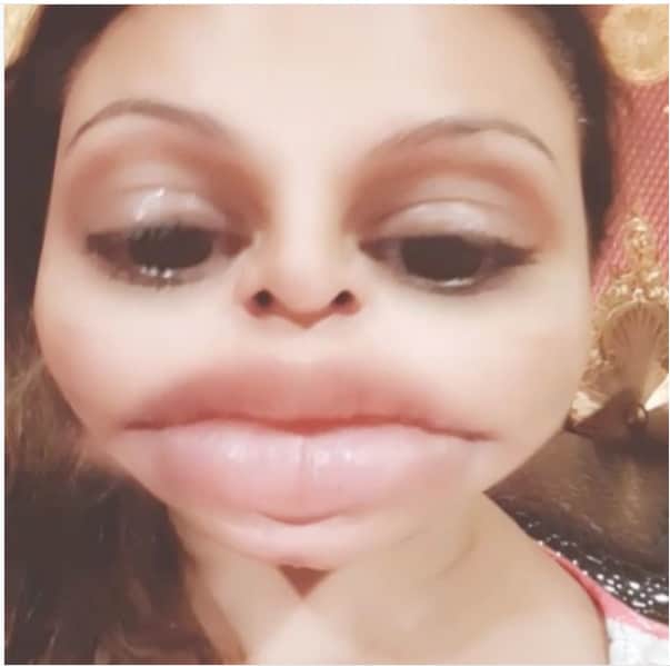 Rakhi Sawant said to sawara bhasker on open letter teri satak gayi hai