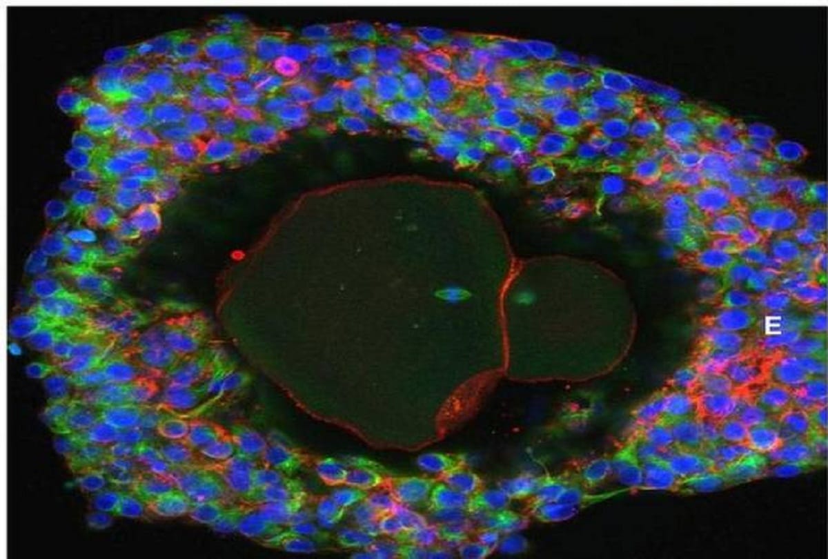 Scientists have succeeded in developing the human eggs grown in lab for the first time