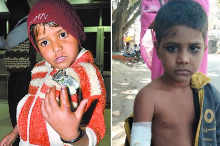 street dogs bitten two children in lucknow 
