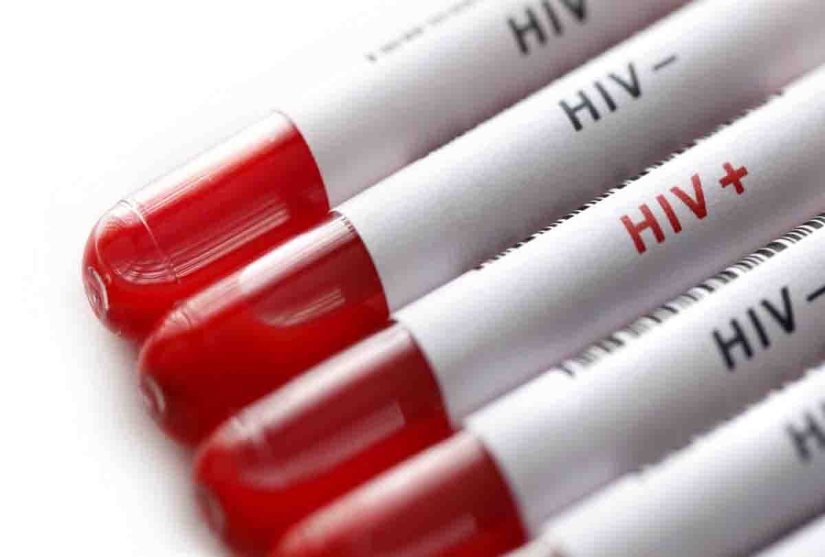 HIV stands for human immunodeficiency virus