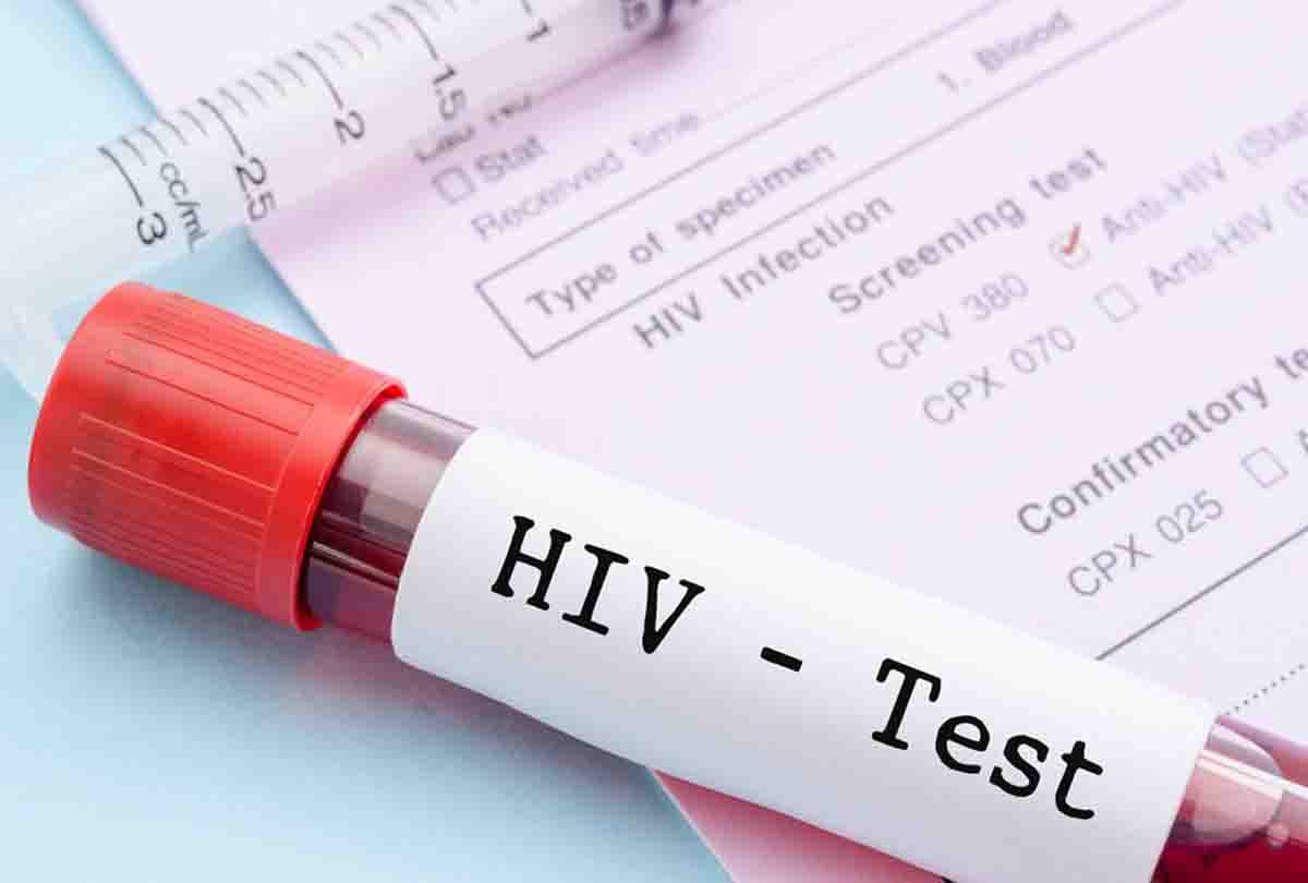 HIV stands for human immunodeficiency virus