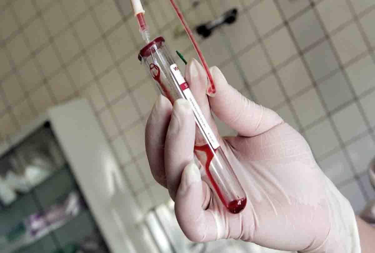 HIV stands for human immunodeficiency virus