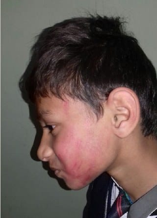 Student beaten up by teacher
