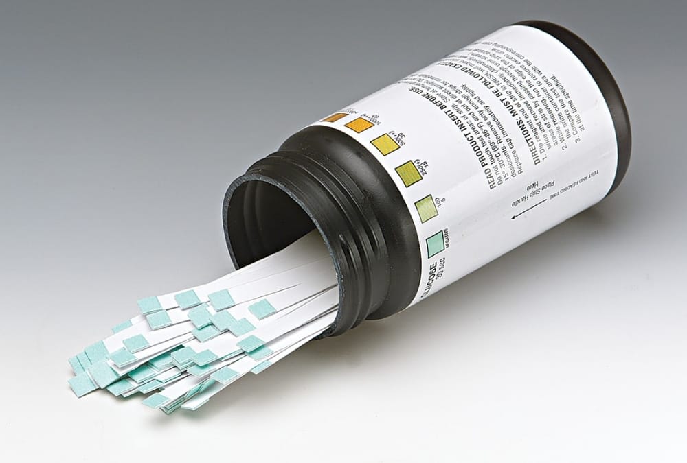 10 rupees strips will reveal kidney infection