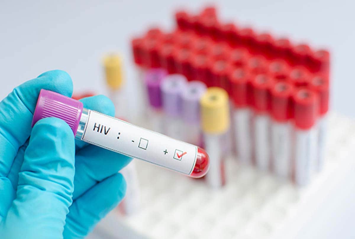 hiv effects on two village of unnao