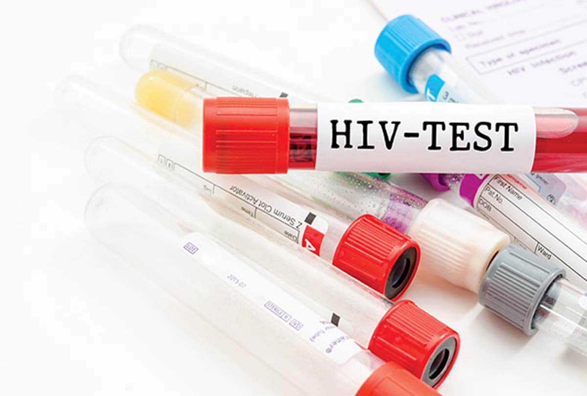 hiv effects on two village of unnao