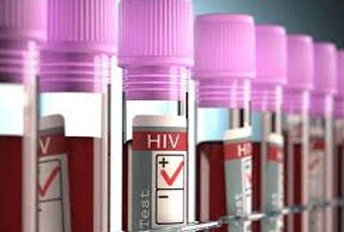 hiv effects on two village of unnao