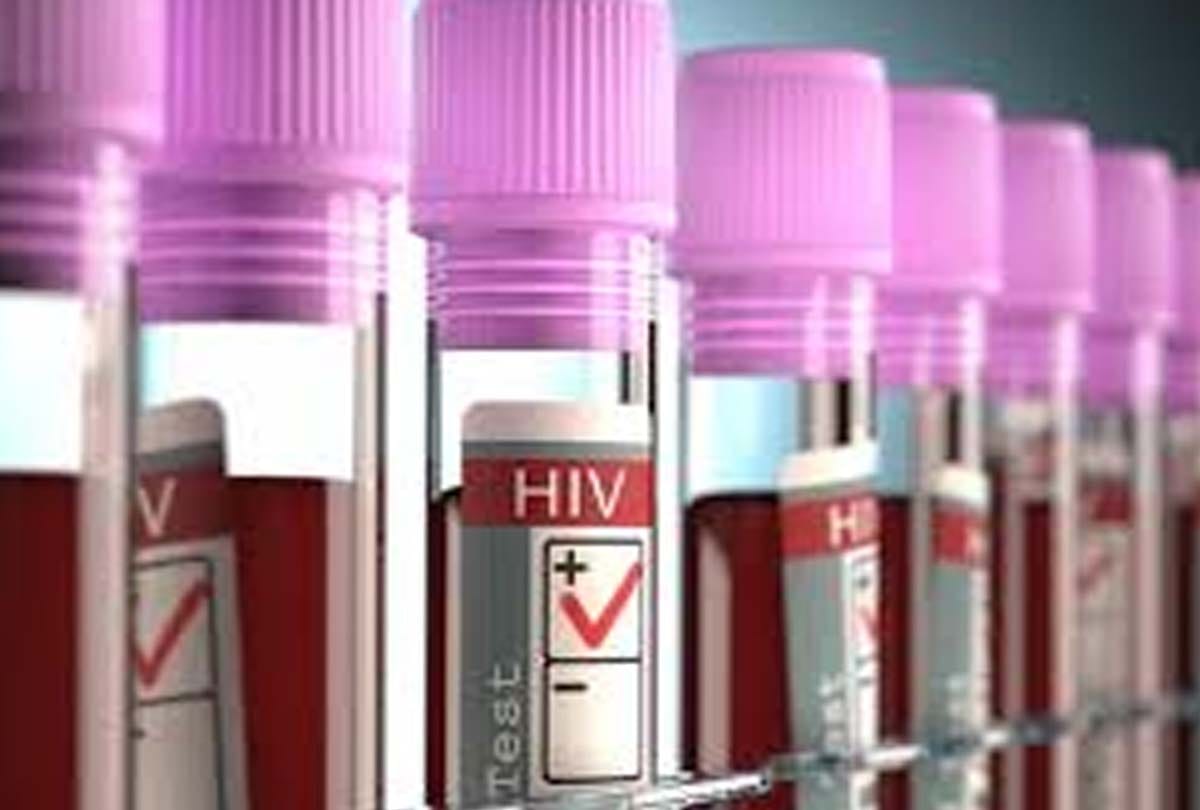 hiv effects on two village of unnao