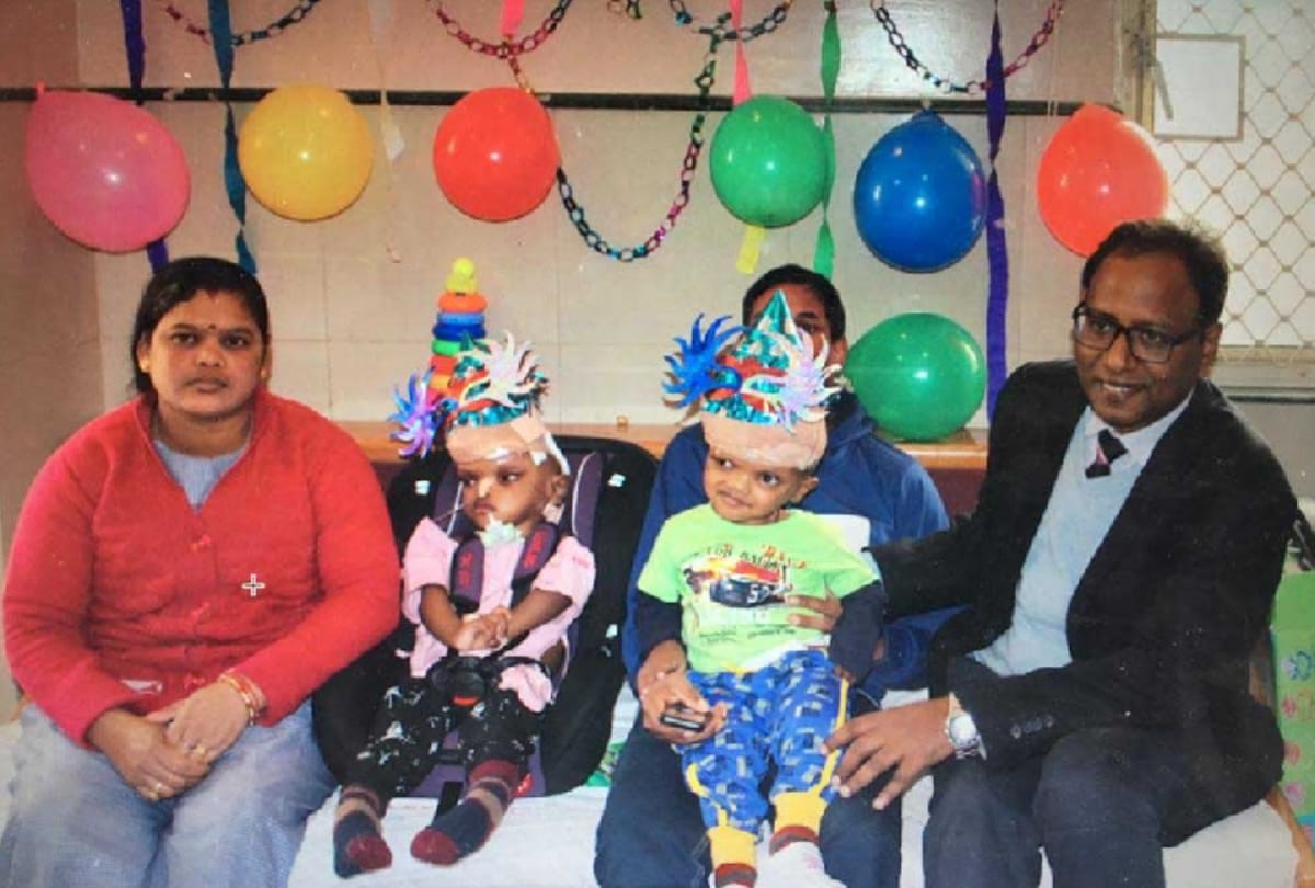 aiims 125 doctors daily practice on 3d head before separation of odisha brothers attach from head