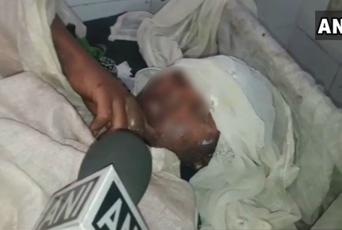 minor dalit girl set ablaze in madhya pradesh after she resist over rape