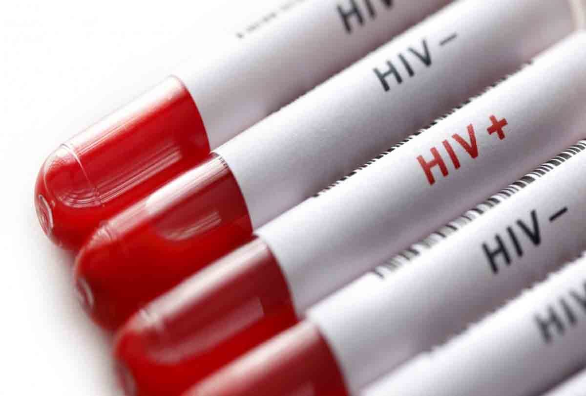 human immunodeficiency virus test 