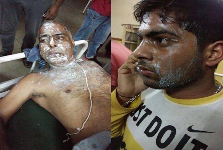 Acid Attack- the past few acid attack-s stories which were nailbiting 