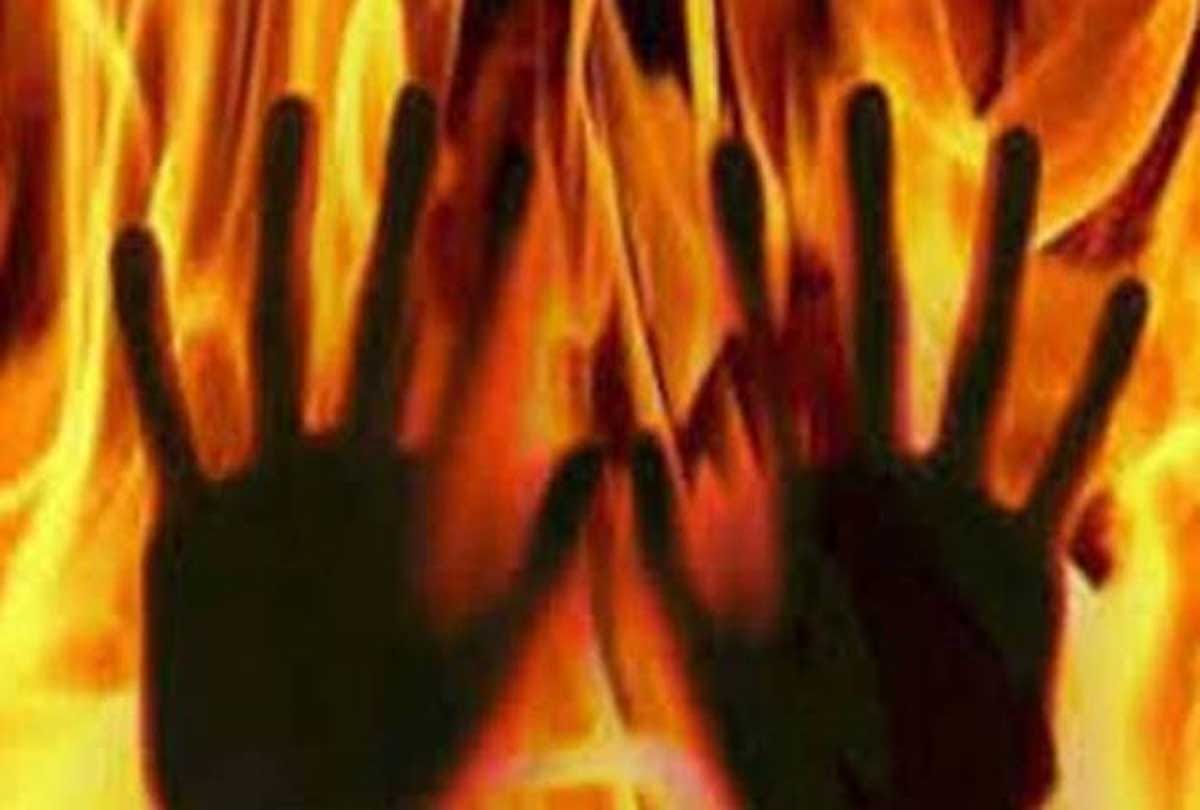 husband burned mother with child
