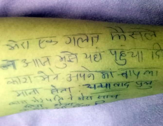 girl commited hanging suicide, wrote suicide note on wrist against in-laws