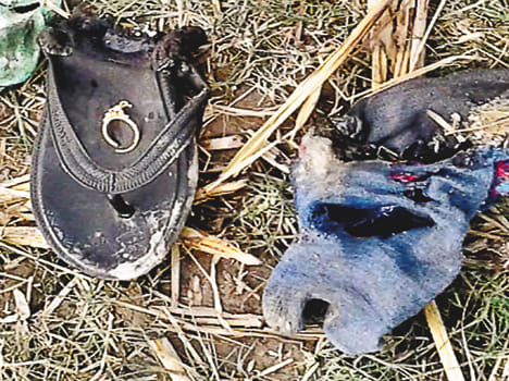 The woman in Etawah shot dead the body of gasoline
