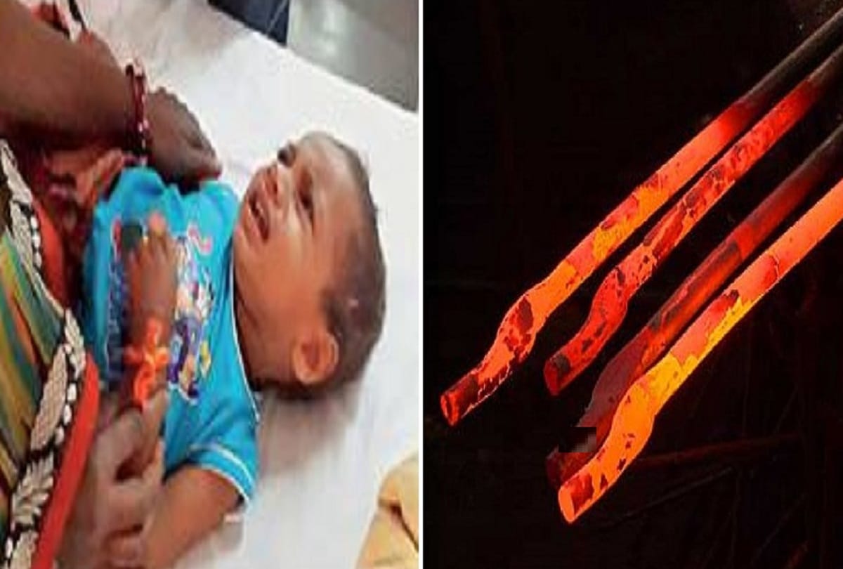 Superstition in rajasthan, child admitted to hospital in critical stage