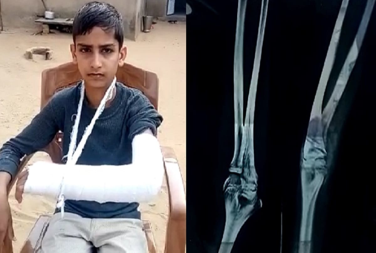 Student beaten by school teacher in alwar rajasthan
