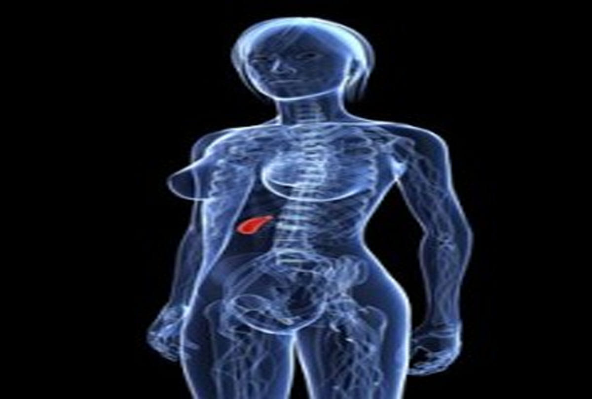 Gaul bladder disappears from teacher's stomach