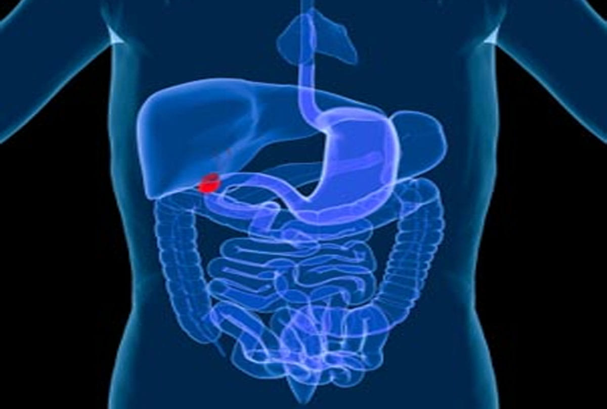 Gaul bladder disappears from teacher's stomach