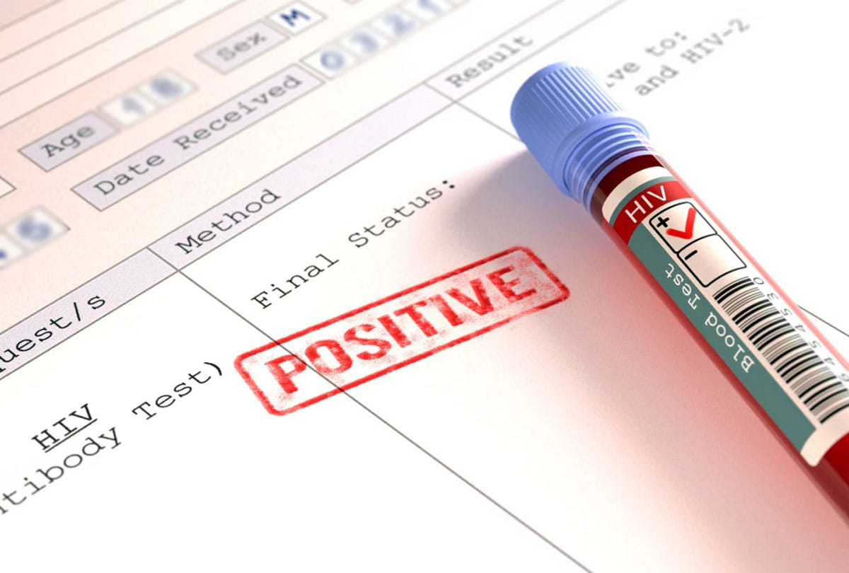 another hiv case in hardoi uttar pradesh