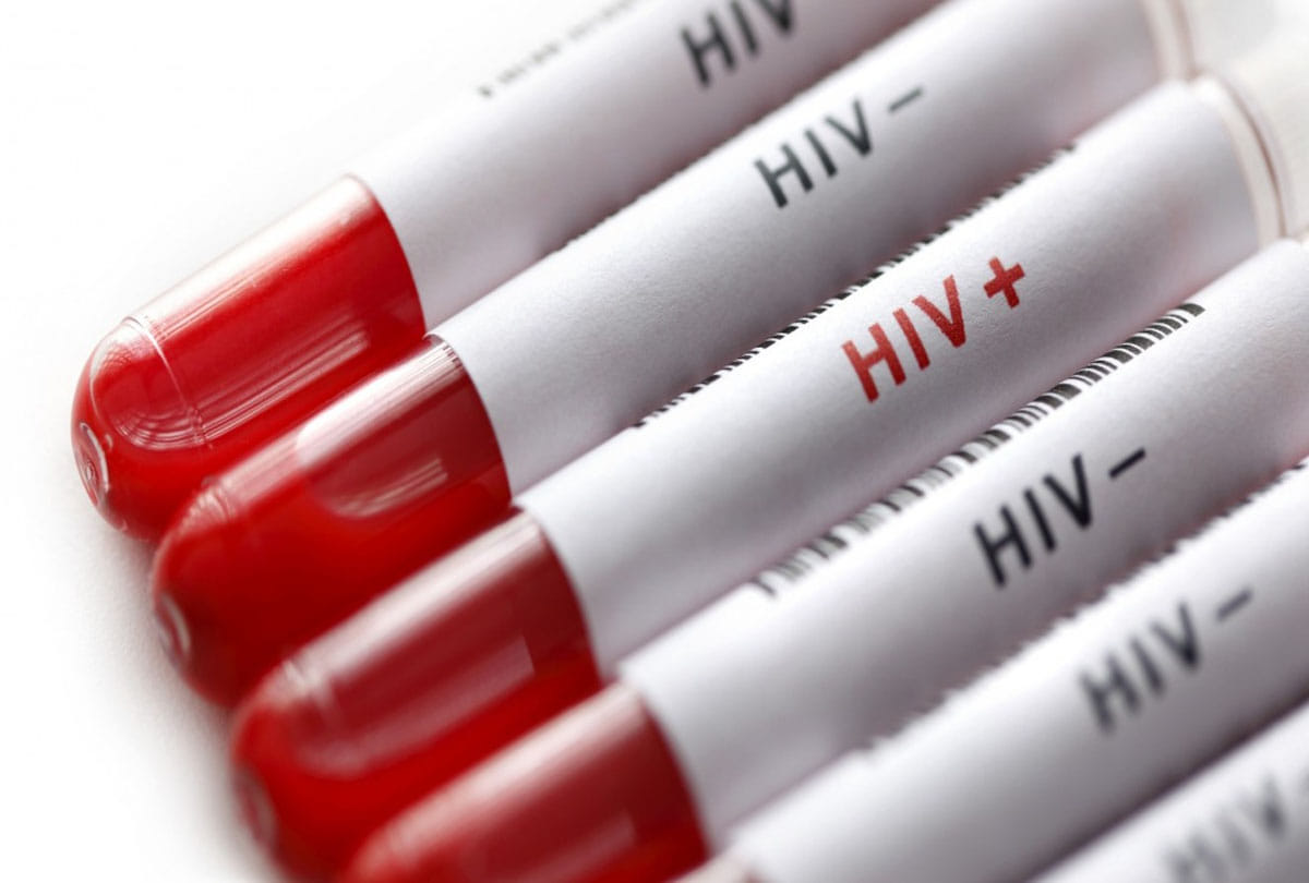 another hiv case in hardoi uttar pradesh