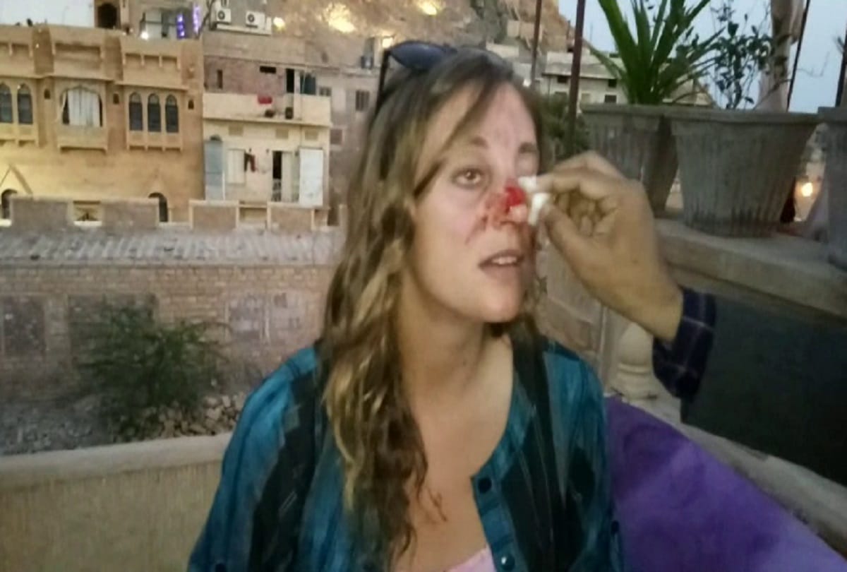 Rajastnan tour : now england tourist injured by street animal on road
