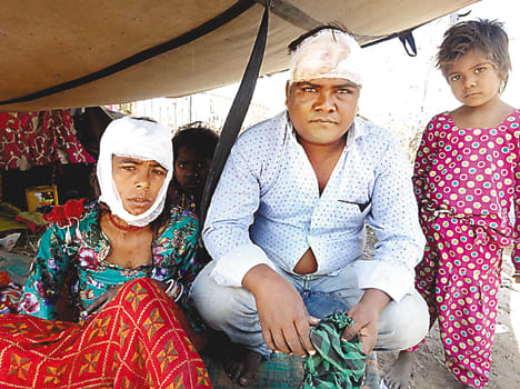 बदमाशों की पिटाई से घायल बिरजू सिंह और उसकी पत्नी गीता।  