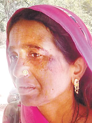 Son beaten by mother's abscess