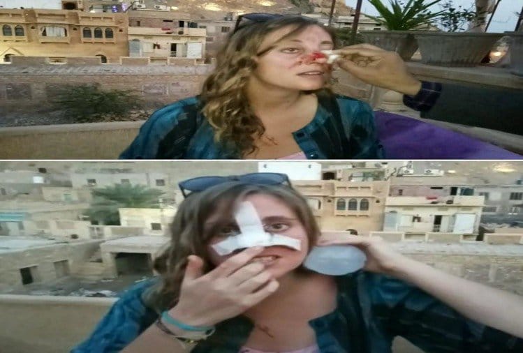 rajasthan tourism- tourist was attacked by stray animal