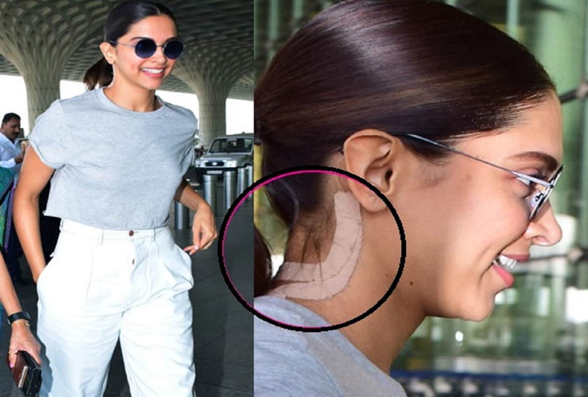 Deepika Padukone battling several health issues