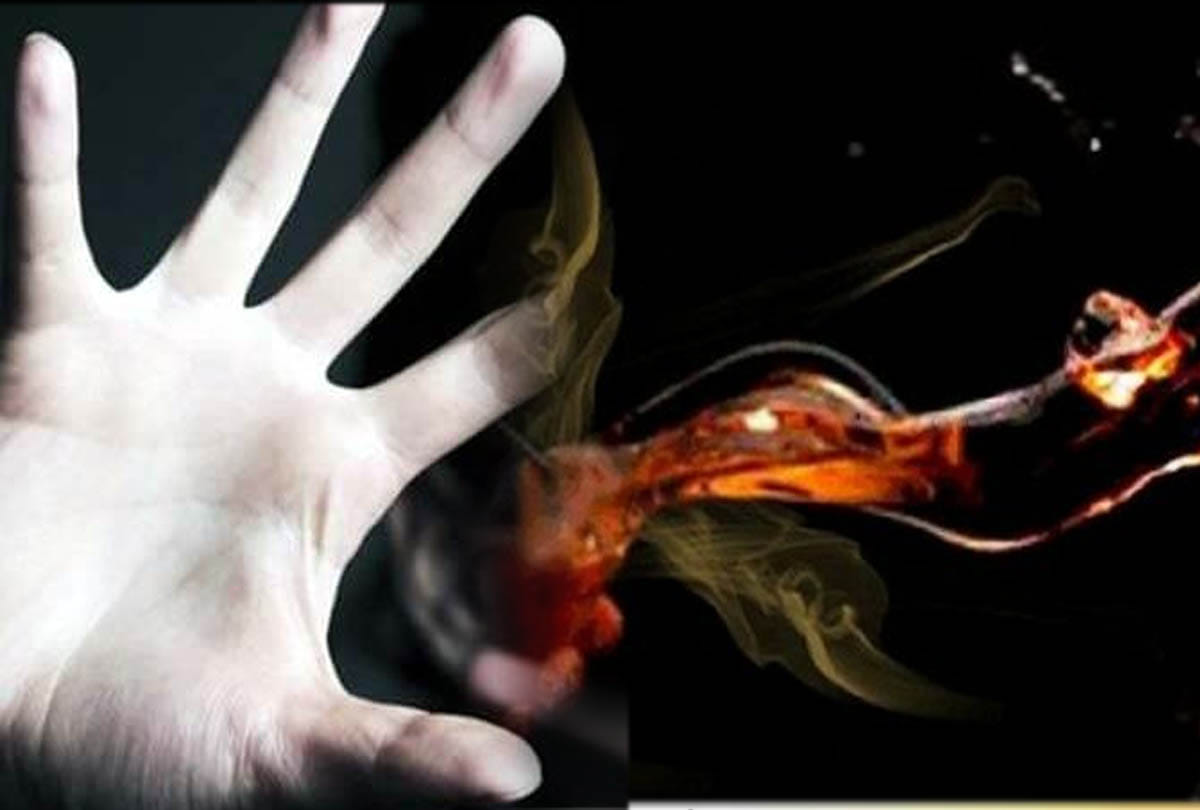 Acid poured over girl and two others