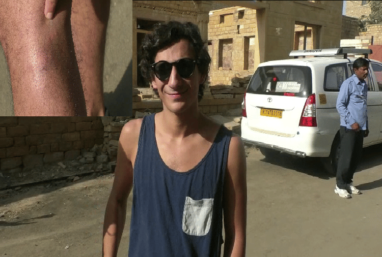 rajasthan jaisalmer stray dog attacked a foreign tourists once again in the city