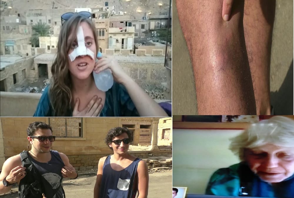 rajasthan tourism- tourist was attacked by stray animal