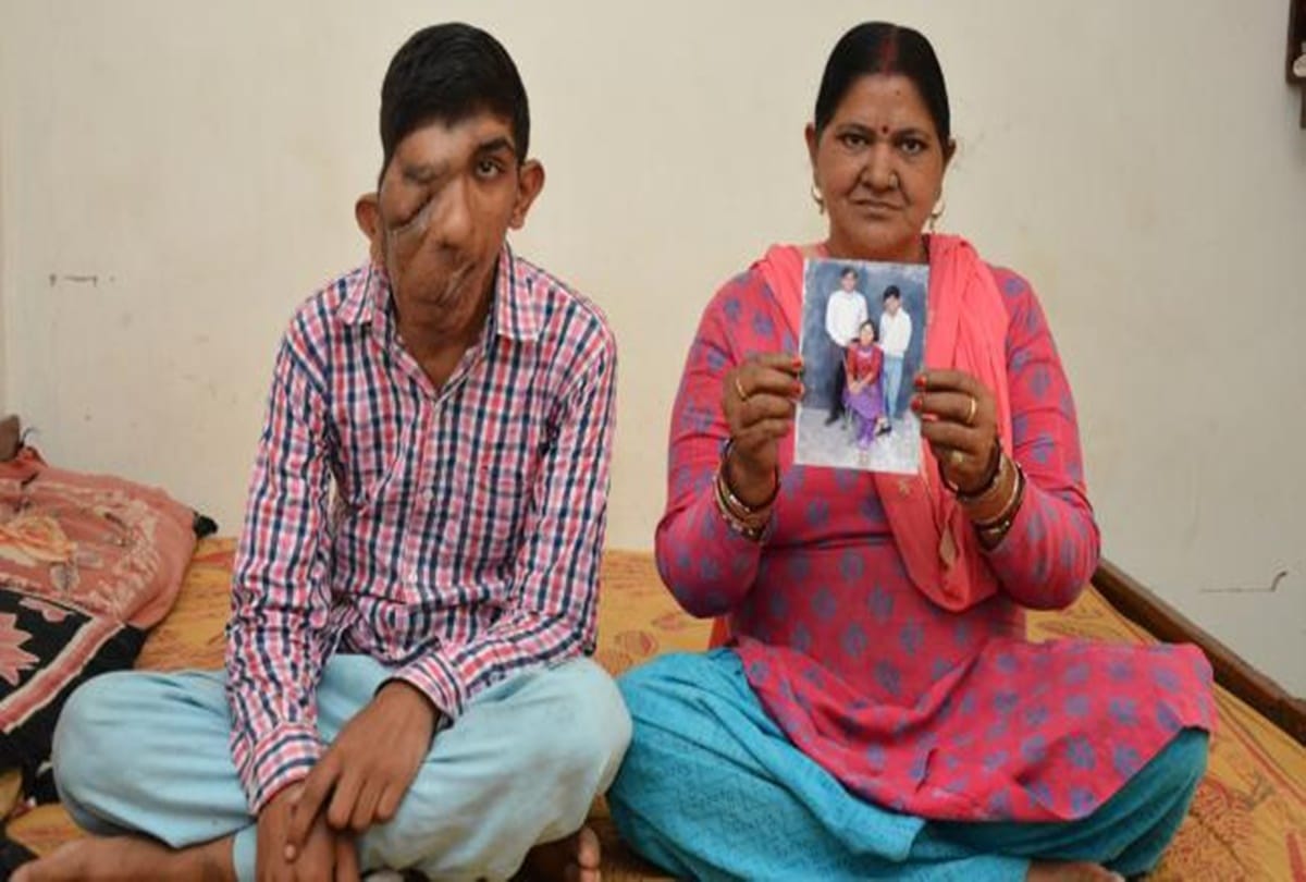 Indian teen suffering from skin rare disease