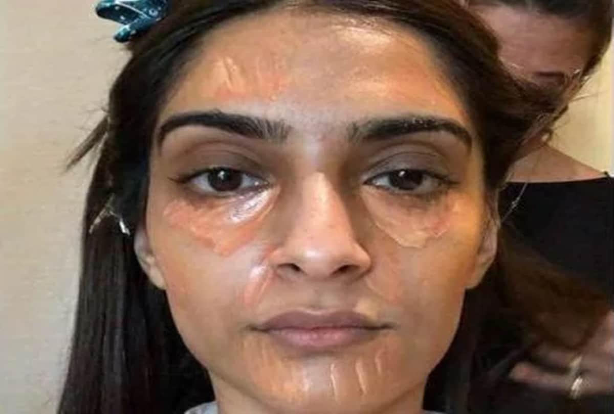 Sonam Kapoor bursts all the beauty myths of celebrities