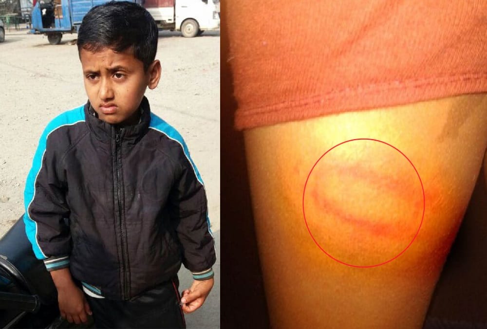 Teacher Arrested for student brutally beaten in udham singh nagar
