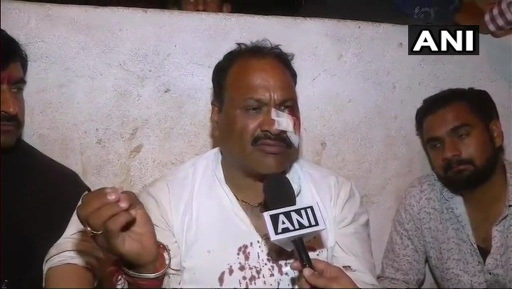 Madhya Pradesh: congress candidate got injured in lathicharge before by election in shivpuri