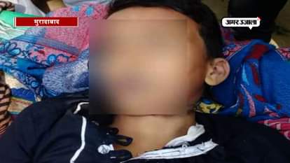 SUICIDE OF A MADARSA'S STUDENT IN MORADABAD