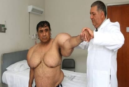 People see me as an animal due to the high weight Says Peru Man 