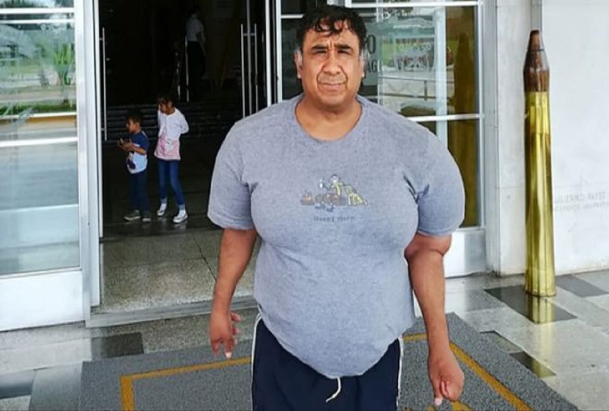 People see me as an animal due to the high weight Says Peru Man 