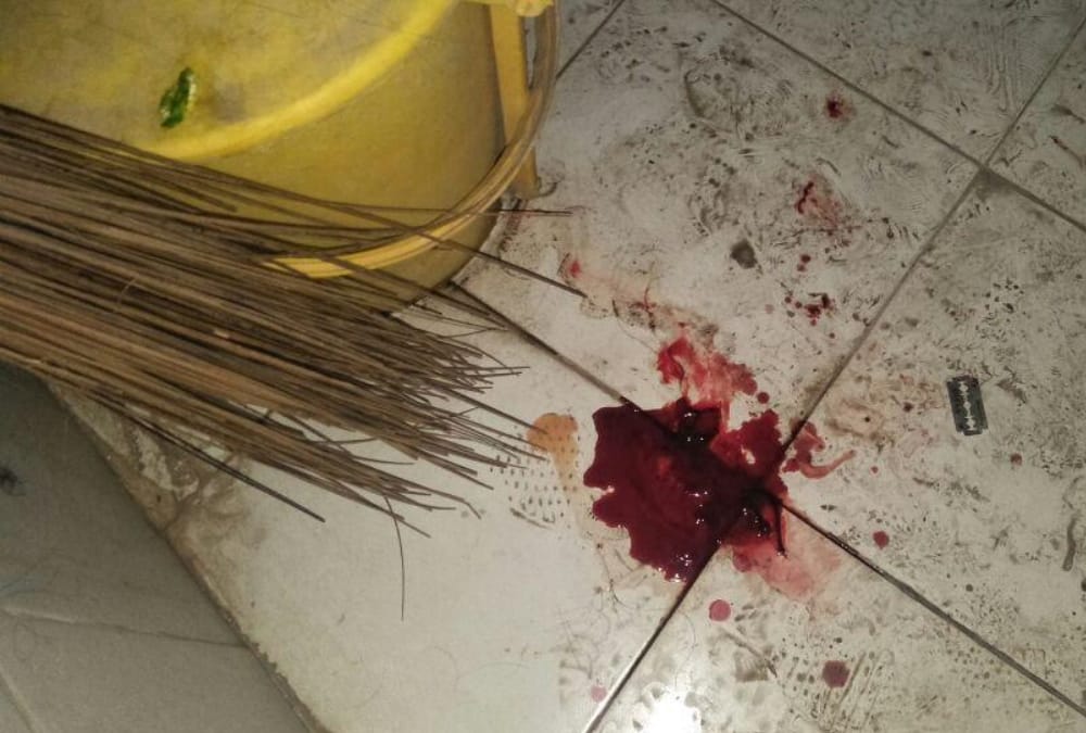 A girl attempted suicide in jn pg college in Lucknow.