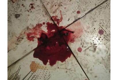 A girl attempted suicide in jn pg college in Lucknow.