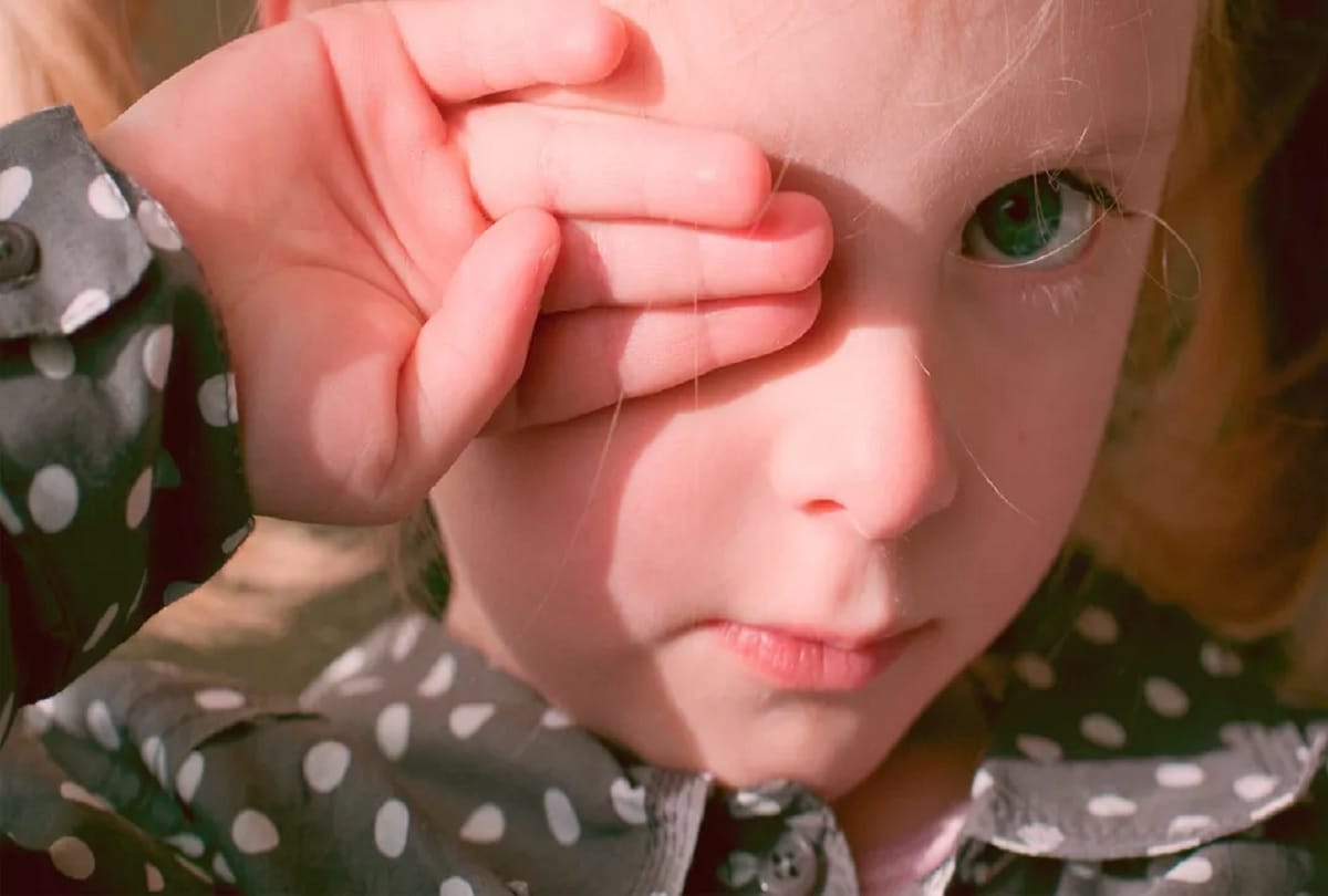  Three year old baby allergy to her tears