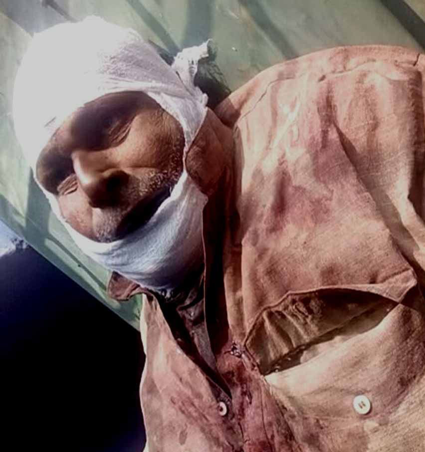 Try to connect with Father's neck sand, then Favicqui.  Injured