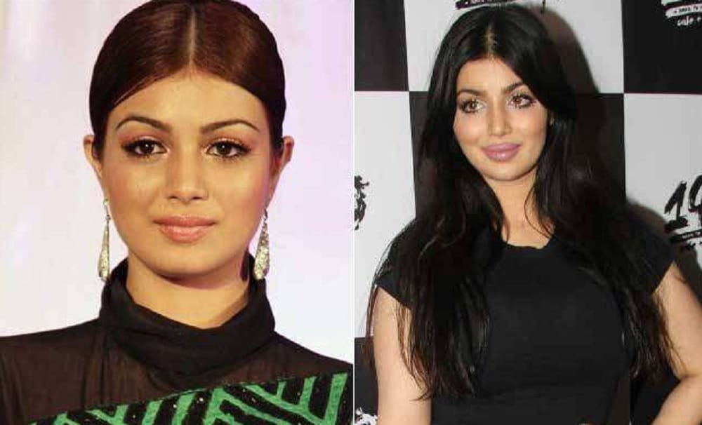 sridevi died due to plastic surgery not because of cardiac arrest 