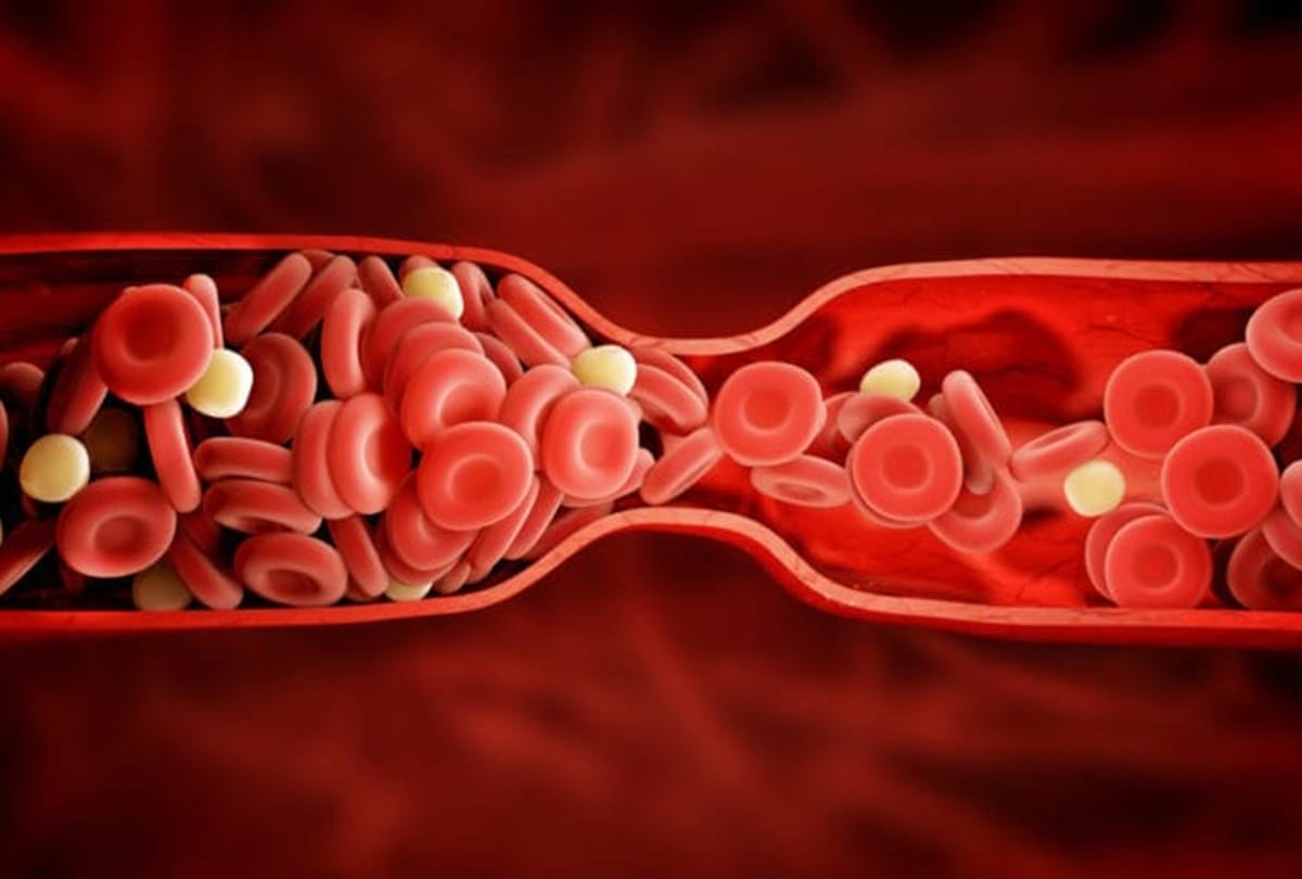 Do You Know If Heart pumps blood out of the body then what will happen