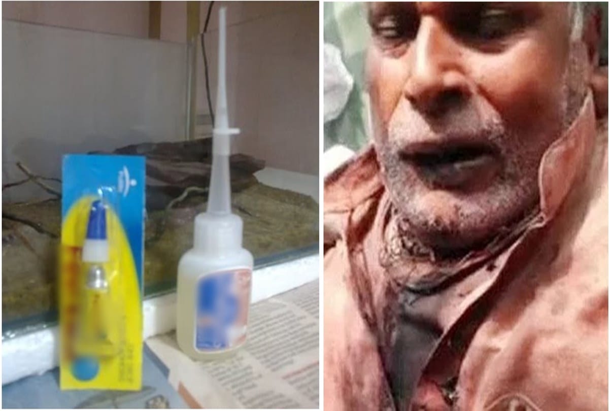 Evil son slashes his dad’s throat, then uses glue in bizarre attempt to stop bleeding