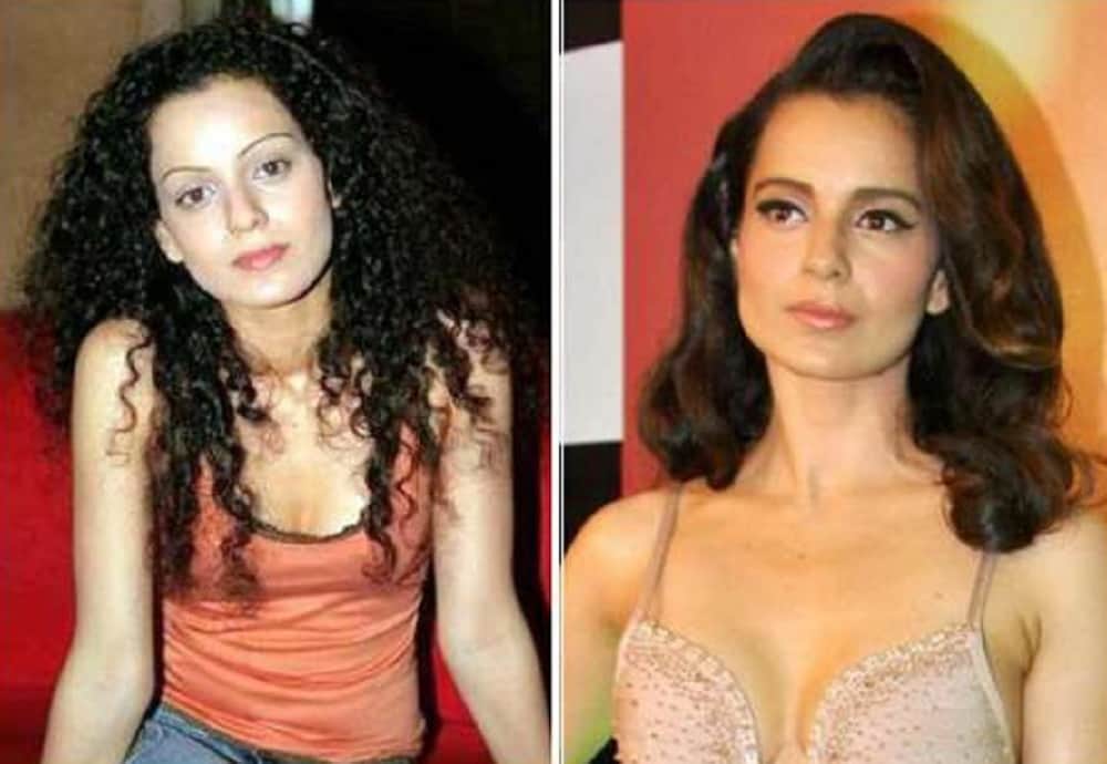 Not only sridevi these five Celebrities also turned Beautiful After Plastic Surgery